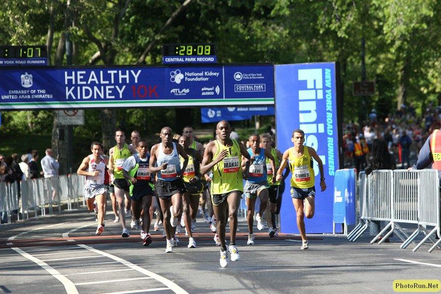 Makau4Record-Kidney08.JPG