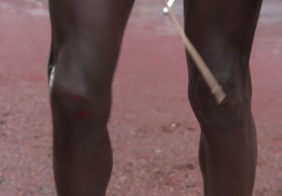 Kamworors bloody knees from broadcast screenshot